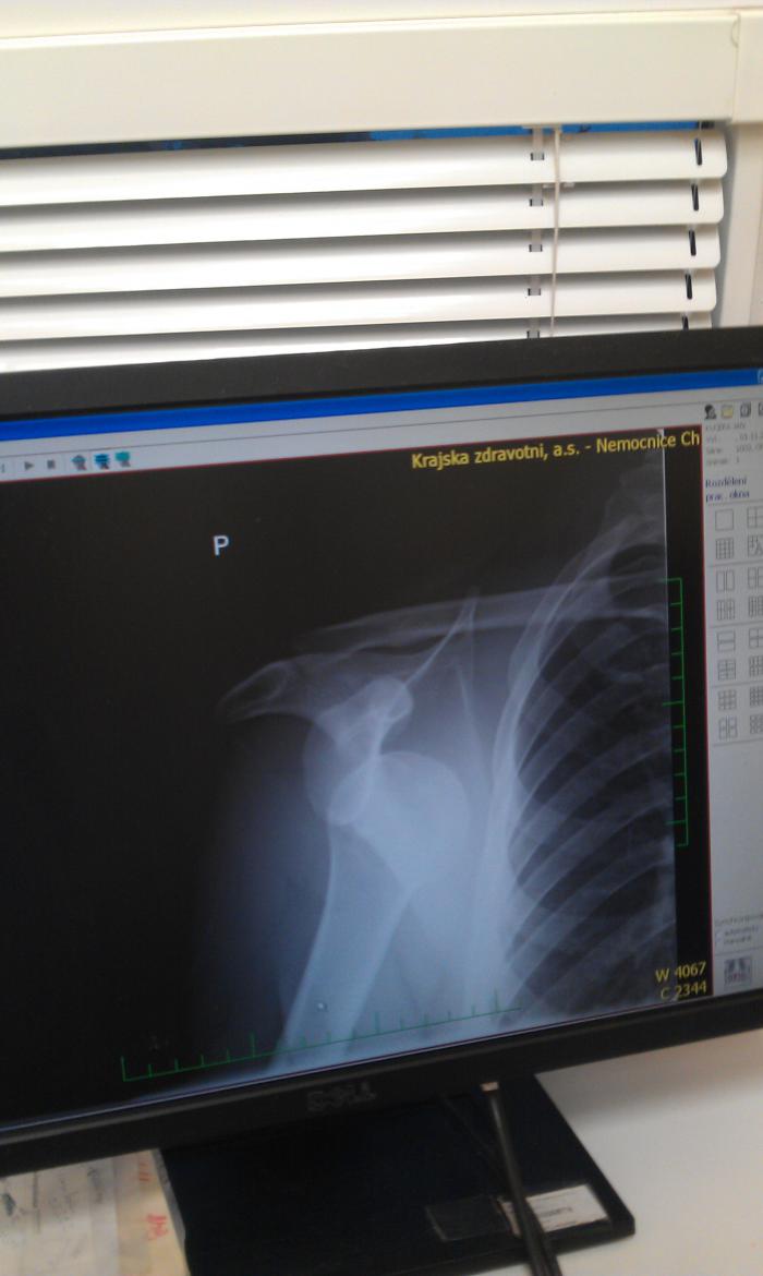 foto k příspěvku  od KaCzaba